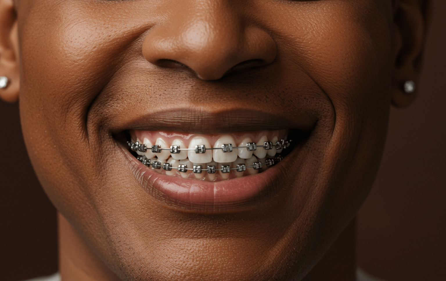 Benefits of Teeth Straightening