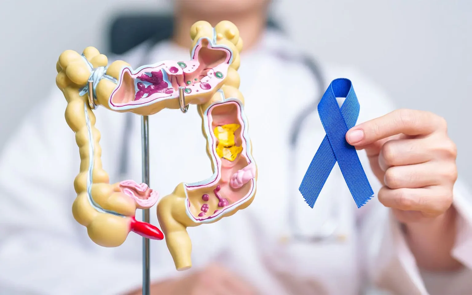 Colon Cancer Screenings