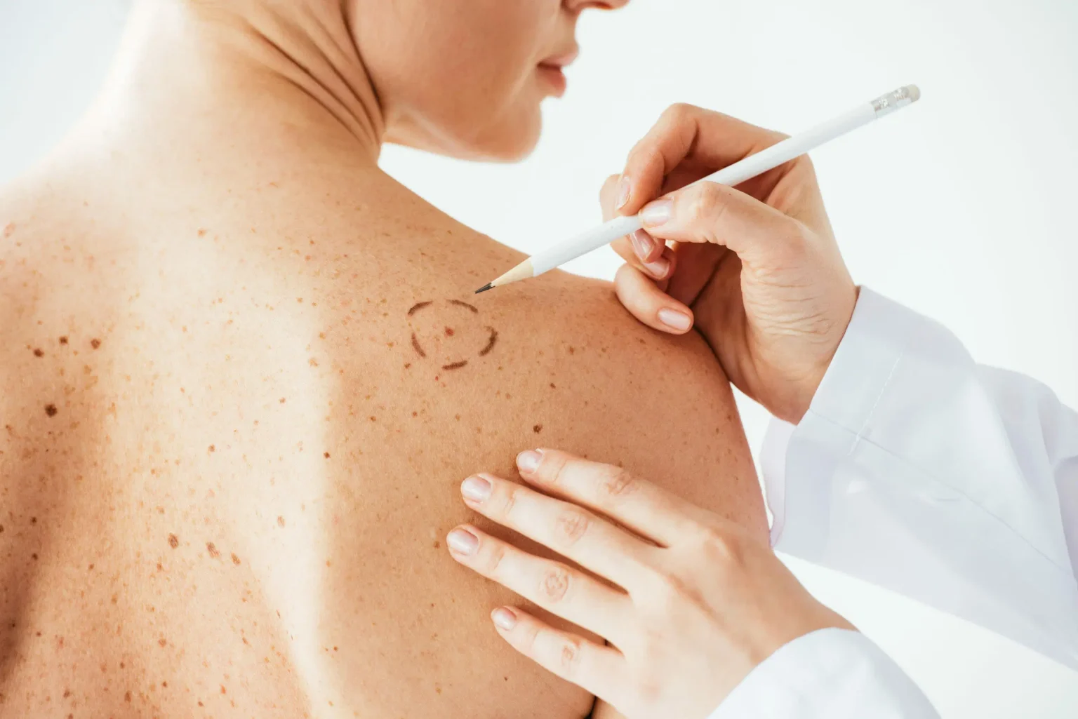 Dermatology Education for Patients