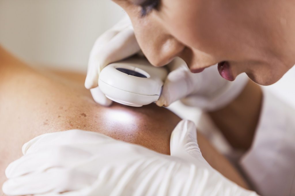 Skin Cancer Detection