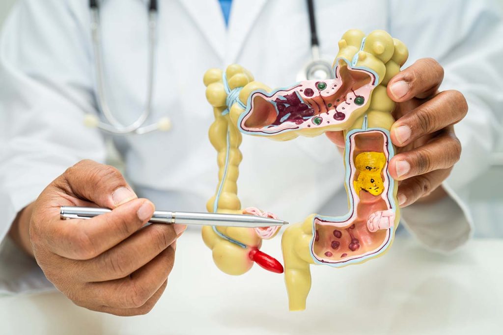 Understanding the Role of Colonoscopy for Early Detection of Diseases and Cancers Role of Colonoscopy for Early Detection of Diseases and Cancers