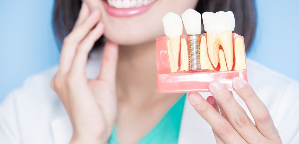 Critical Factor for Successful Tooth Replacement