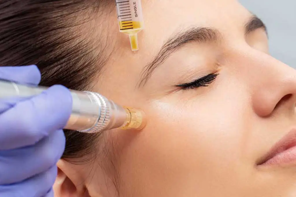What To Expect During Your First Medspa PRP Treatment Medspa PRP Treatment