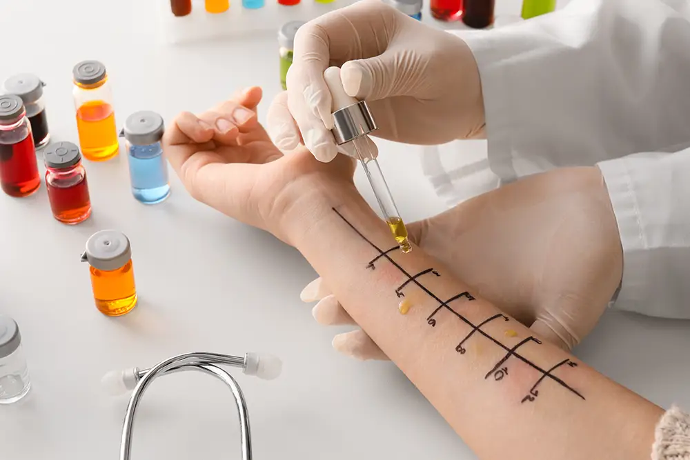 The Role of Allergy Testing in Personalized Allergy Management Allergy Testing