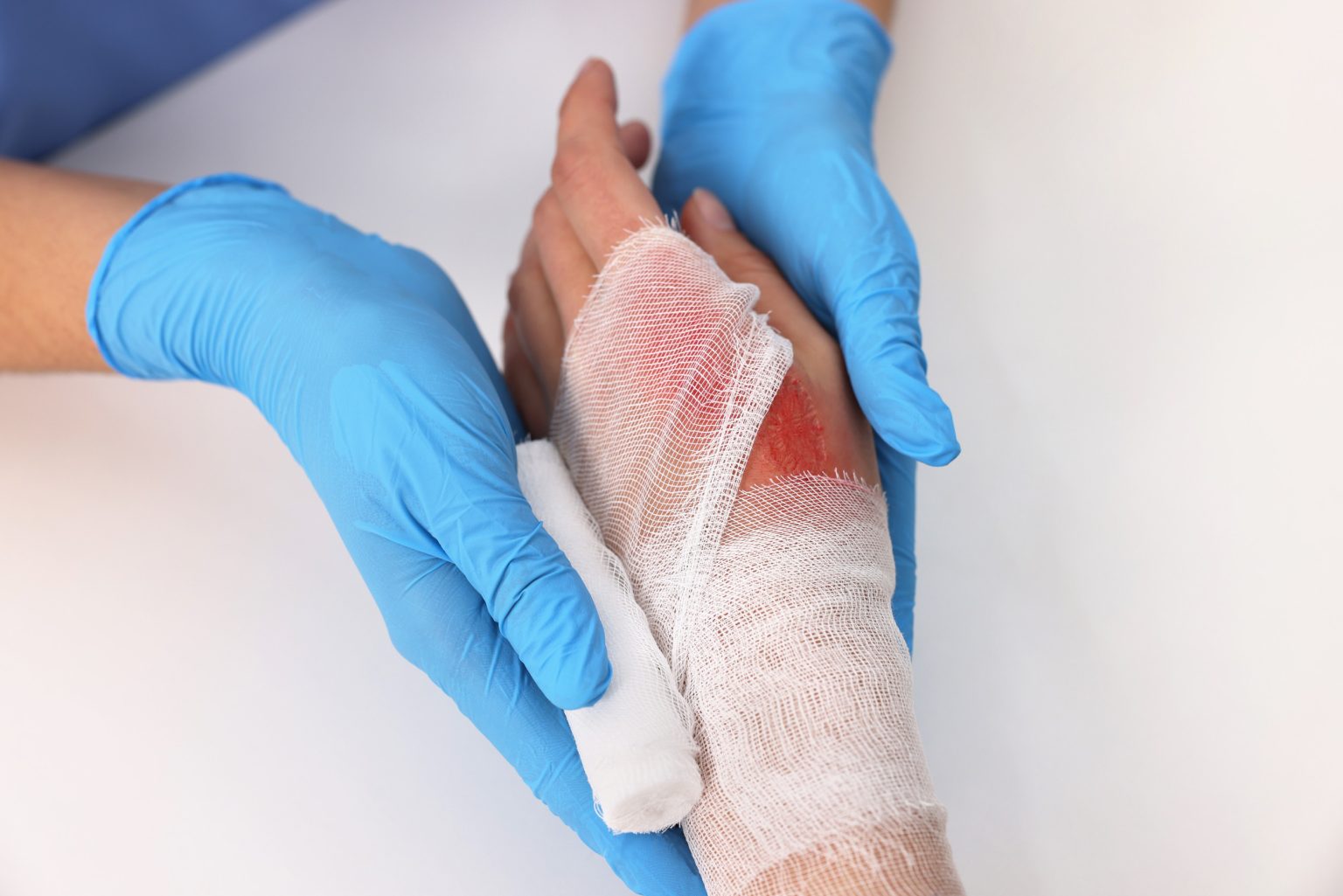 Chronic Wounds and Effective Care Strategies