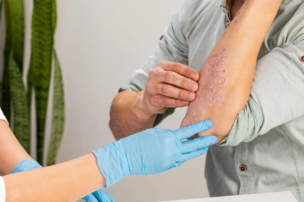 Common Conditions Treated at an Allergy Clinic Conditions Treated at an Allergy Clinic