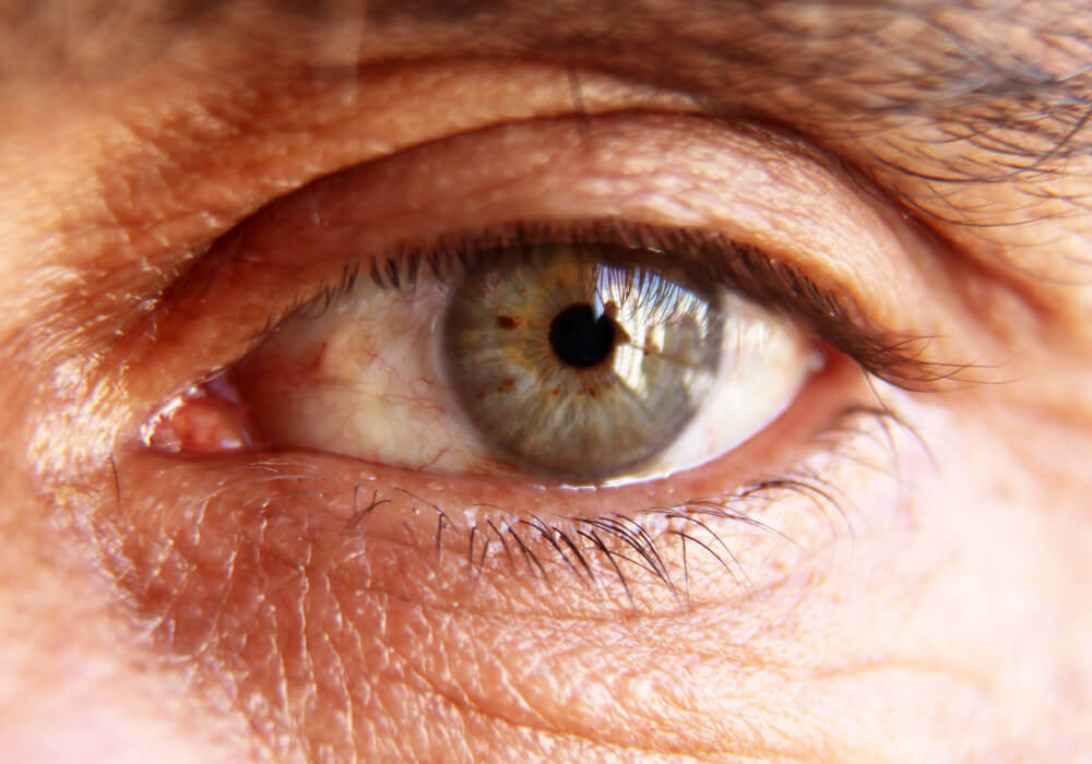 The Impact of Diabetic Eye Disease on Patients Diabetic Eye Disease on Patients
