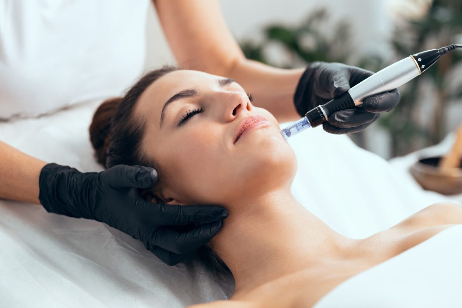 How to Protect Your Skin After Microneedling