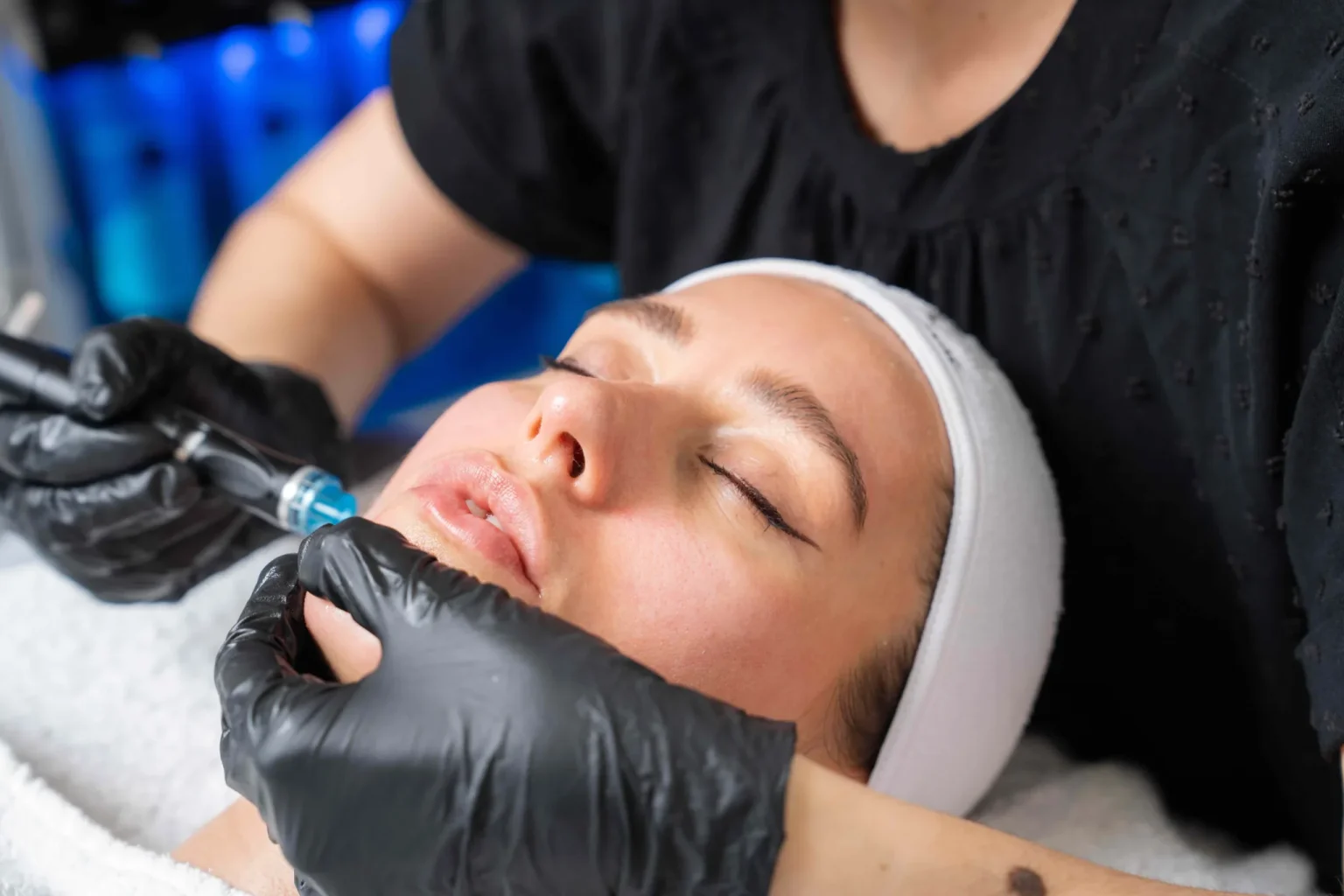 QuantumRF With Hydrafacial for Enhanced Results