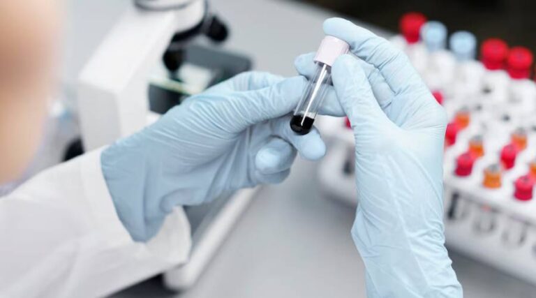 Things To Know About STD Screenings STD Screenings