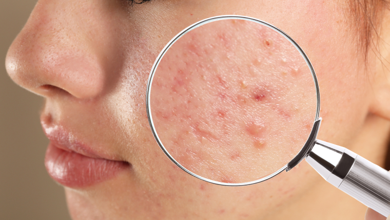 Understanding the Role of Dermatology in Treating Skin Conditions Role of Dermatology