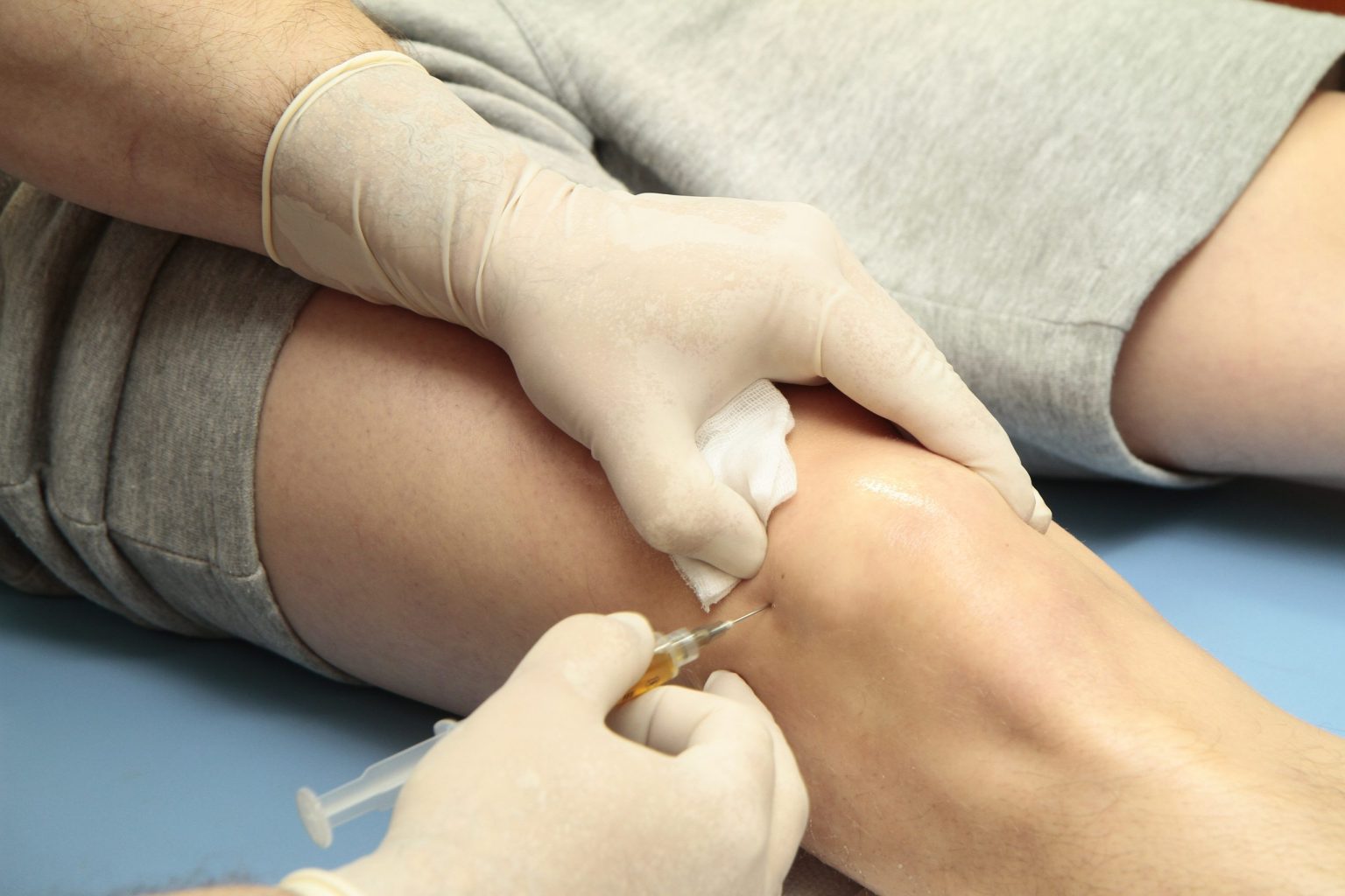 Stem Cell Therapy as an Option for Joint Pain
