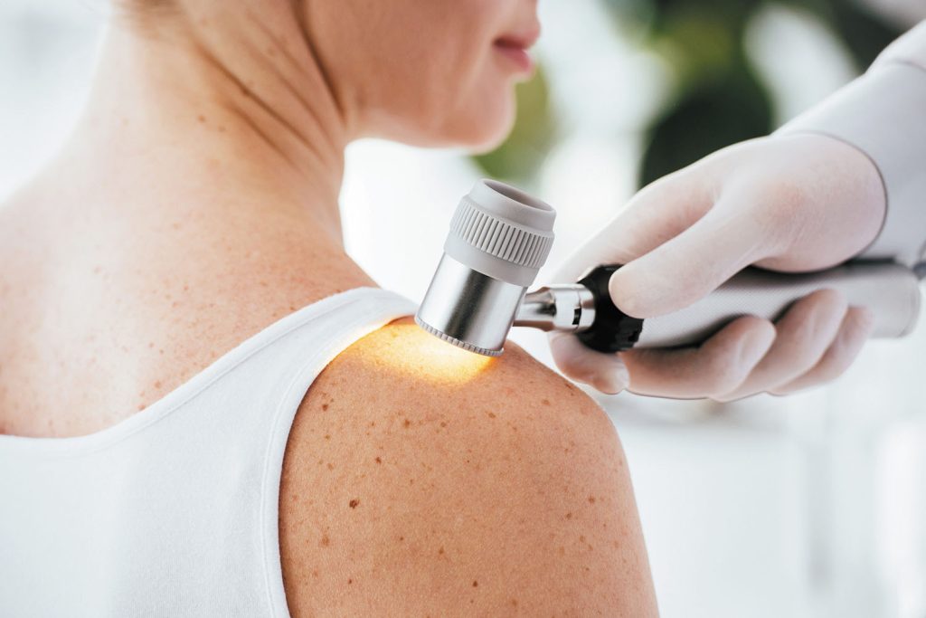 Skin Cancer Check